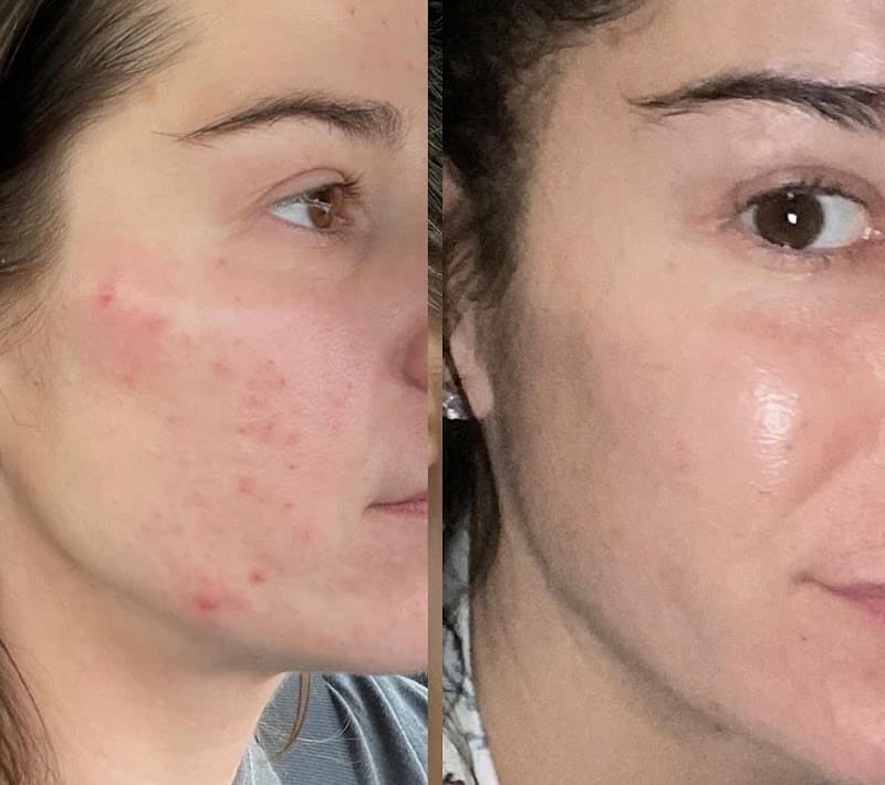 Pelle Sana Facial Spa Hummelstown photo