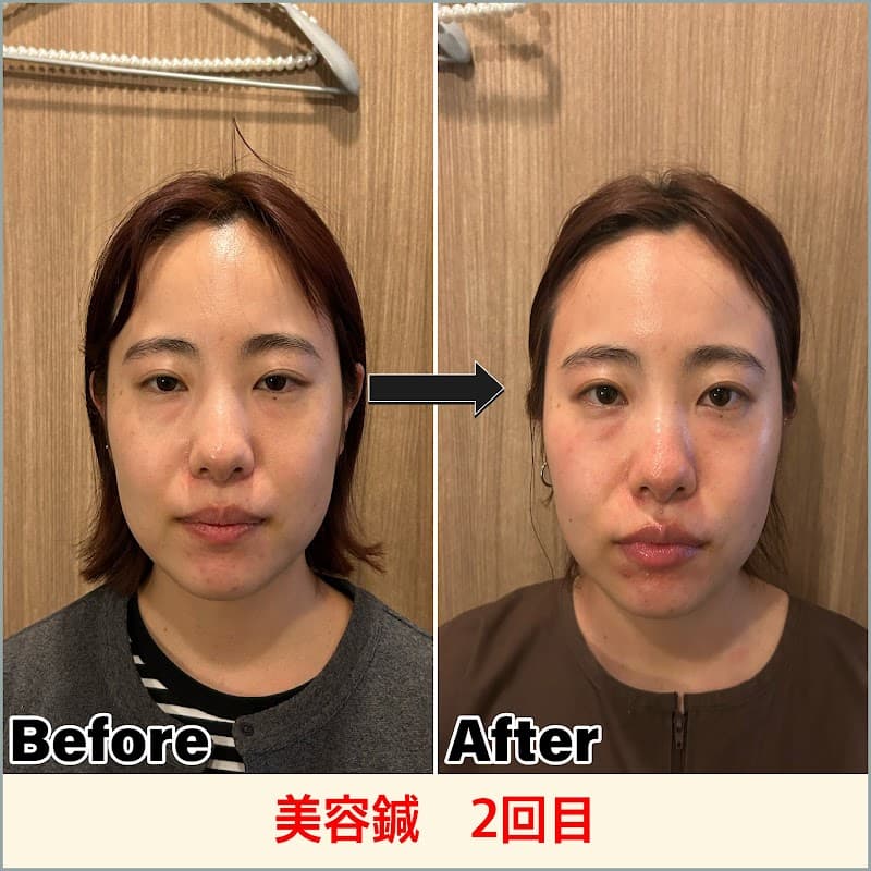 Physiobeauty+/Honancho Acupuncture Clinic Nakano Ward photo