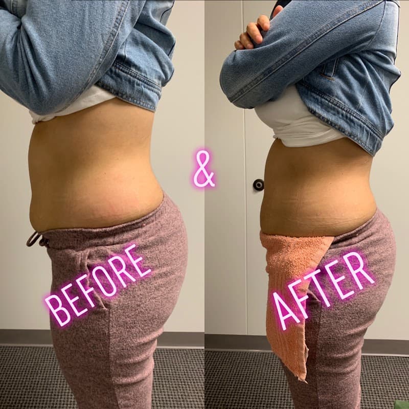 Physique Body Med Spa Houston photo