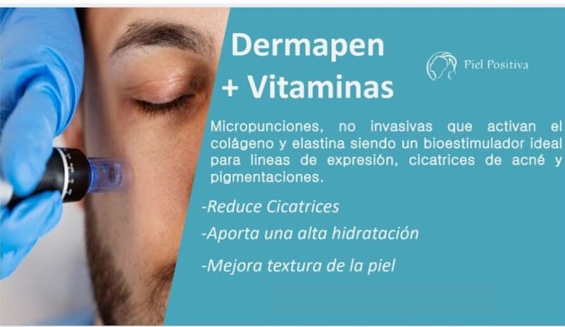 Piel Positiva Nezahualcóyotl photo