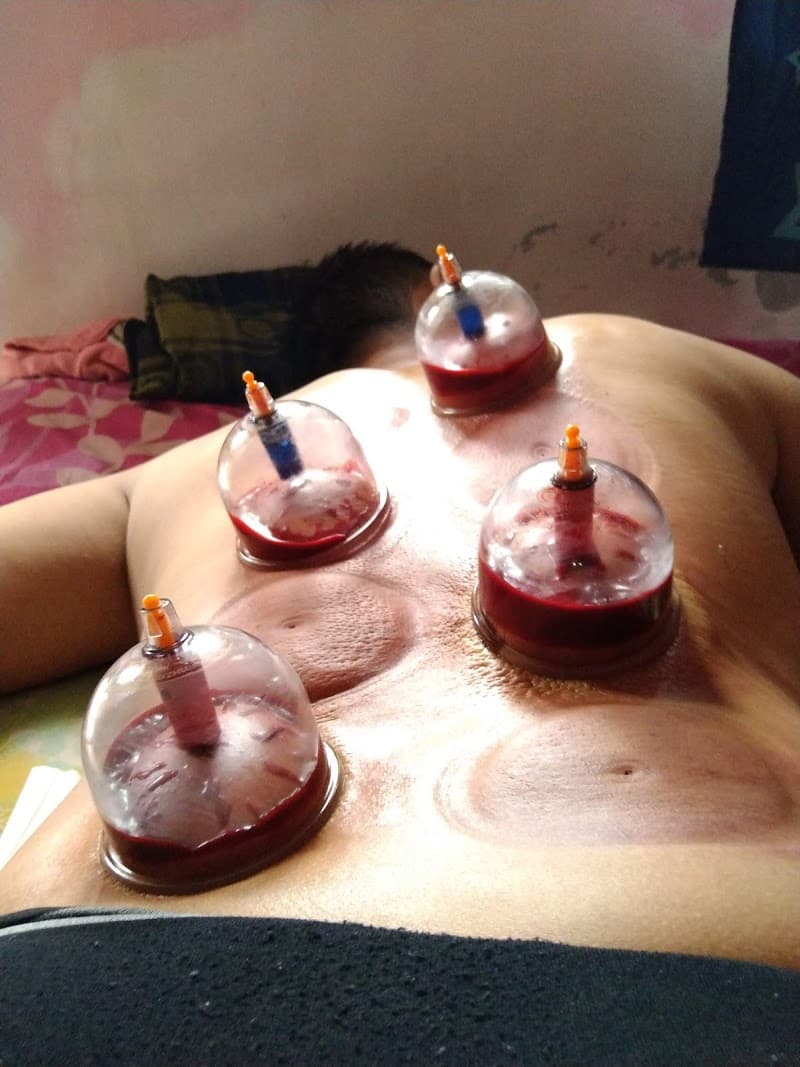 Pijat Massage dan Bekam Panggilan Bali Denpasar photo