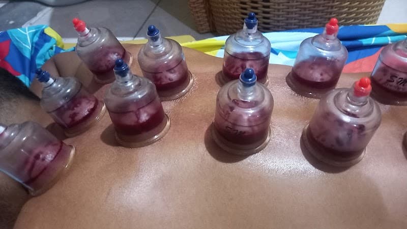 Pijat Repleksi dan bekam di jl ry warungborong ciampea Bogor photo