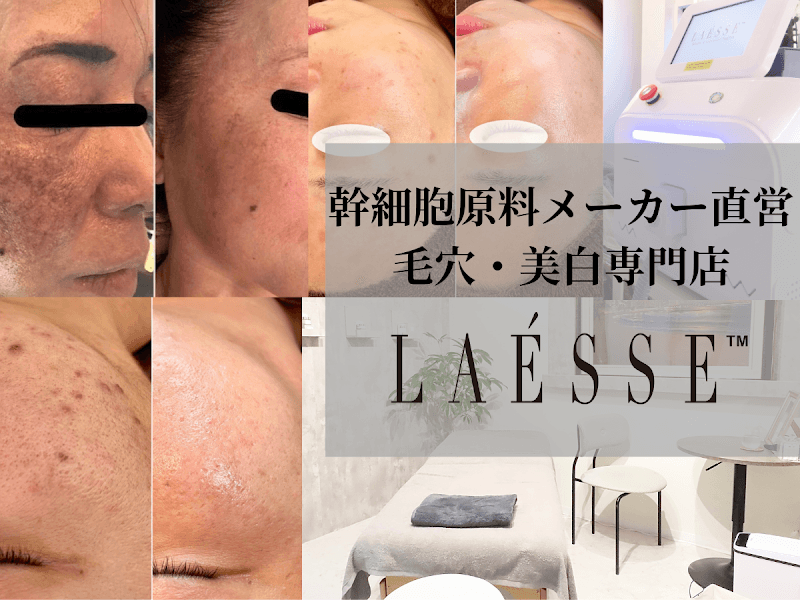 Pore & Whitening Specialty Store Laésse Ebisu Shibuya Ward photo