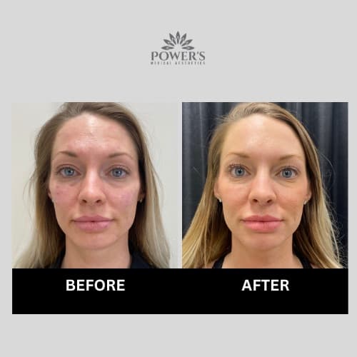Power's Medical Aesthetics Inc Spruce Grove photo