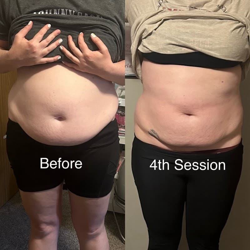 Powers Body Sculpting & Wellness Lincoln photo