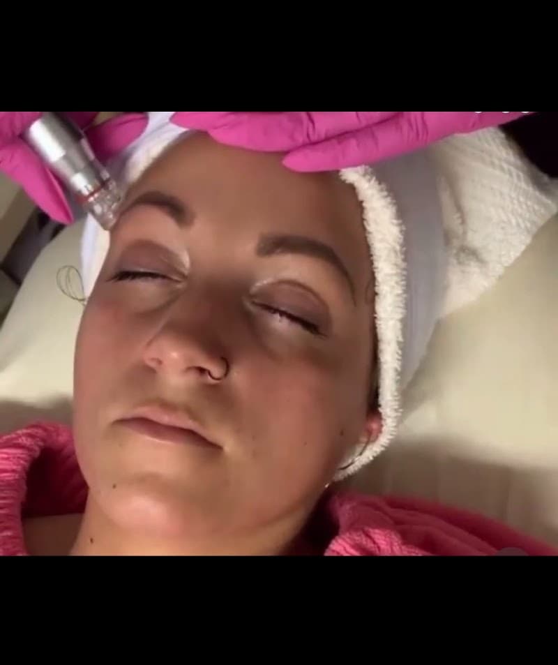 Pretty Lyfe Esthetics Dublin photo