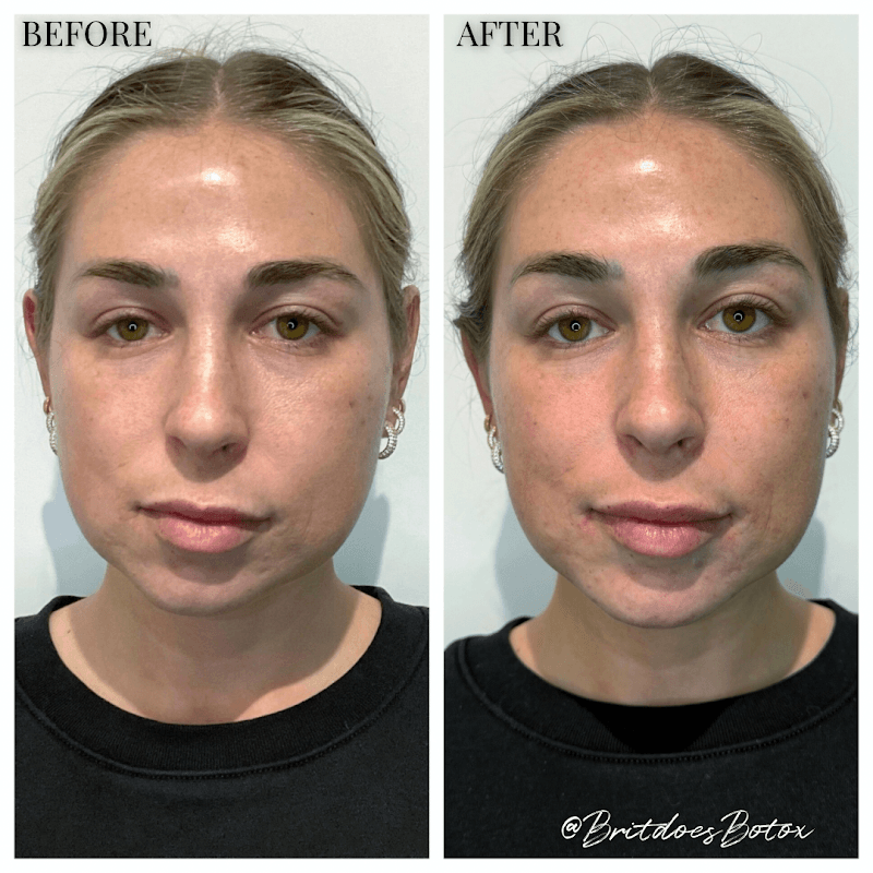 Professional Aesthetic Solutions Escondido photo