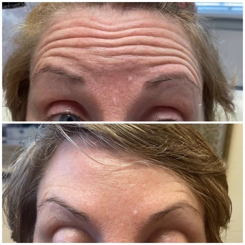 Prolase Medispa Arlington photo