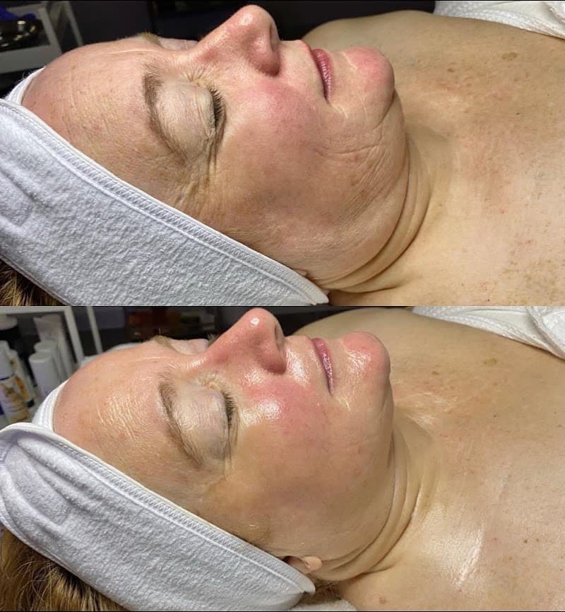 Pure Image Esthetics Willow Park photo