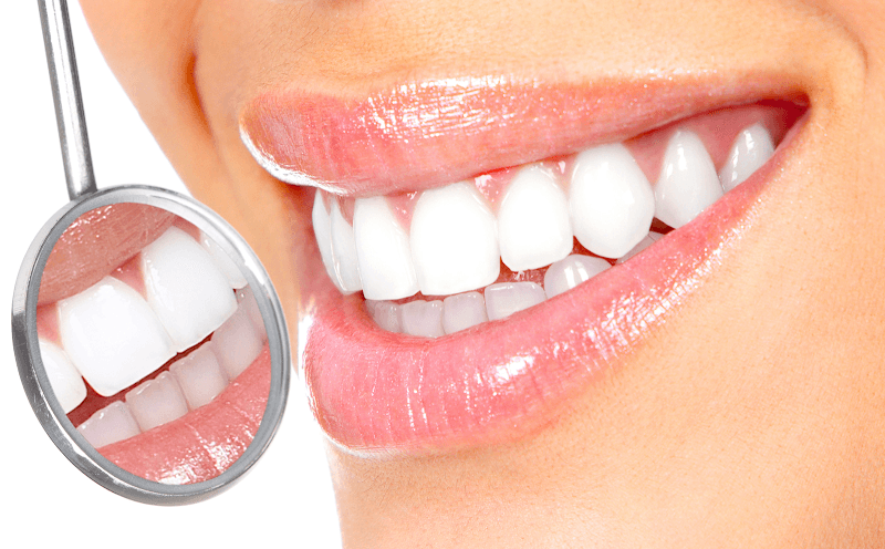 Pure White Advanced Teeth Whitening Long Beach photo