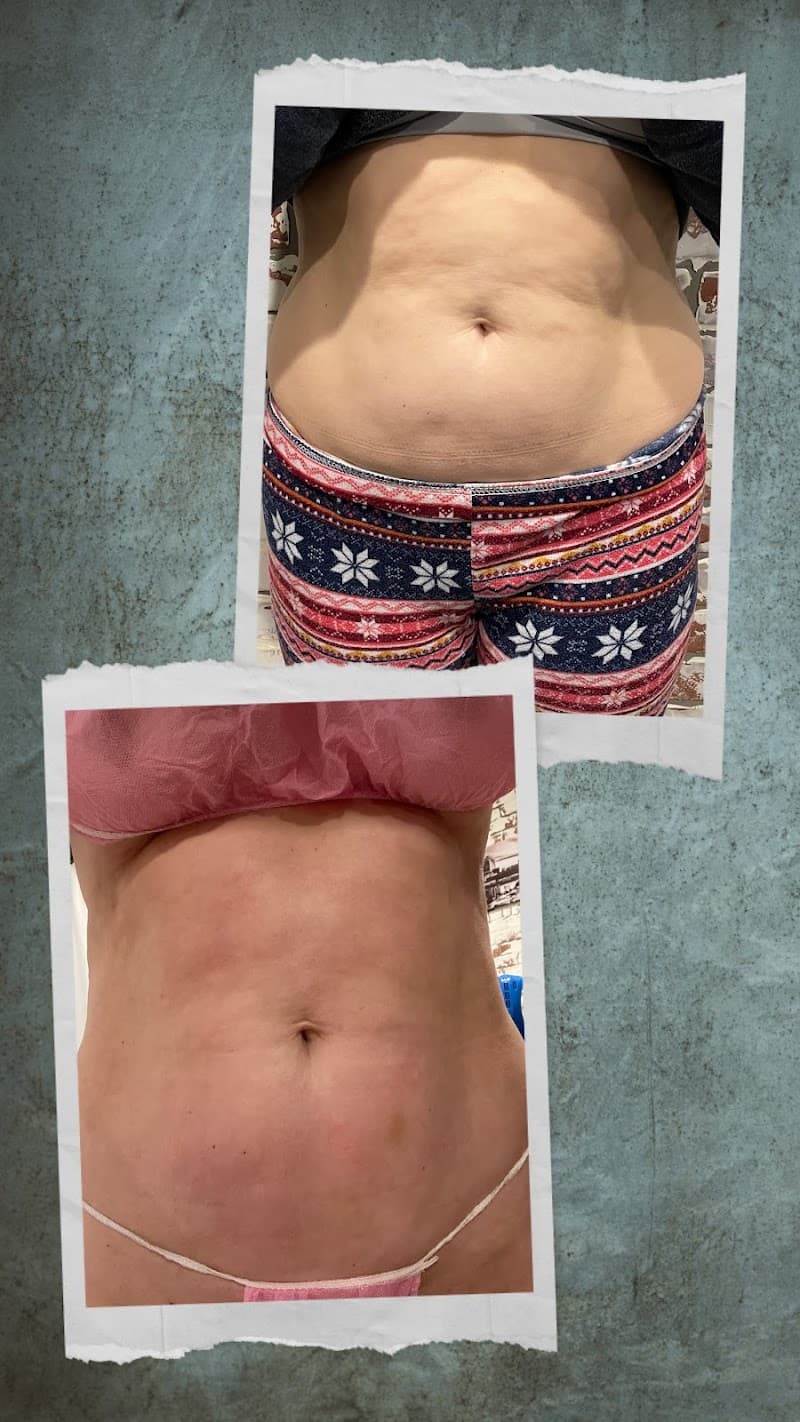 PureSculpt Body and Beauty Cartersville photo