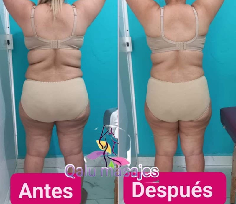 Qalu masajes reductivos Culiacán photo