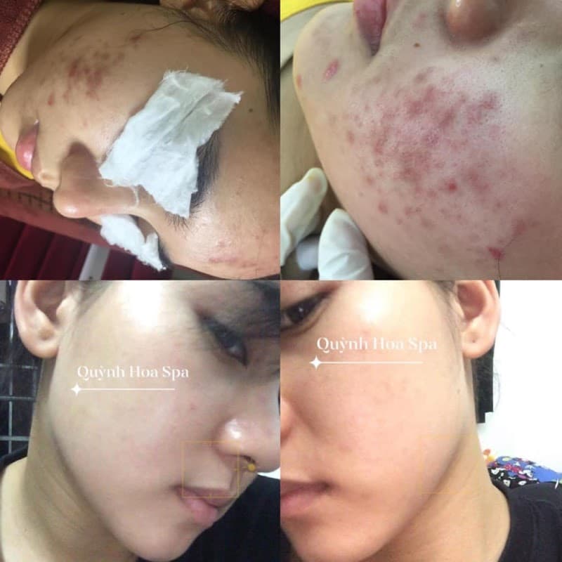 Quỳnh Hoa Beauty Academy Phú Bình photo