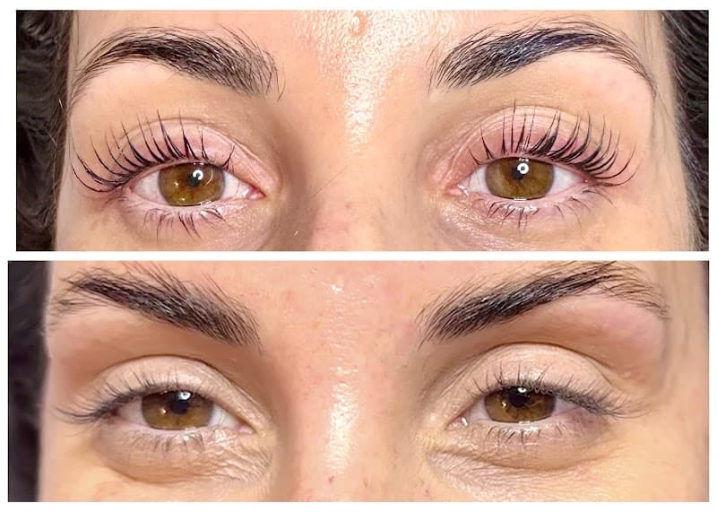 Radiant Light Esthetics Vancouver photo