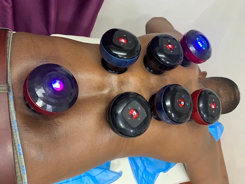 Rashid Hijama Cupping Services Johannesburg photo