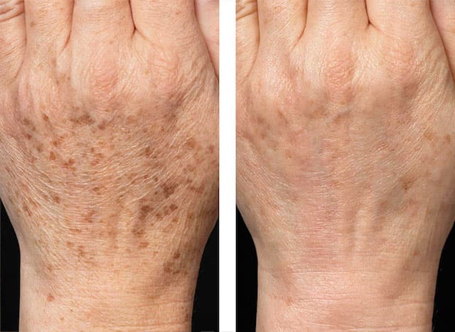 Real Results Skin Care Therapy Fayetteville photo