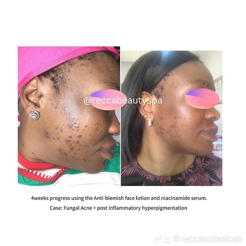 Recca Beauty Spa Lagos photo