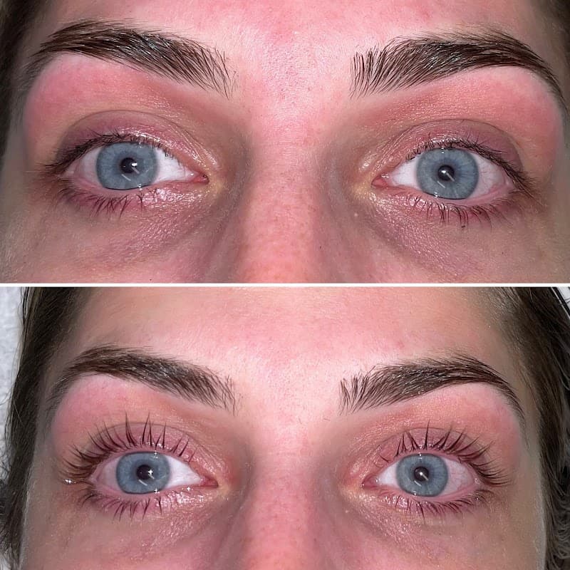 Rejuvenate Aesthetics Gahanna photo