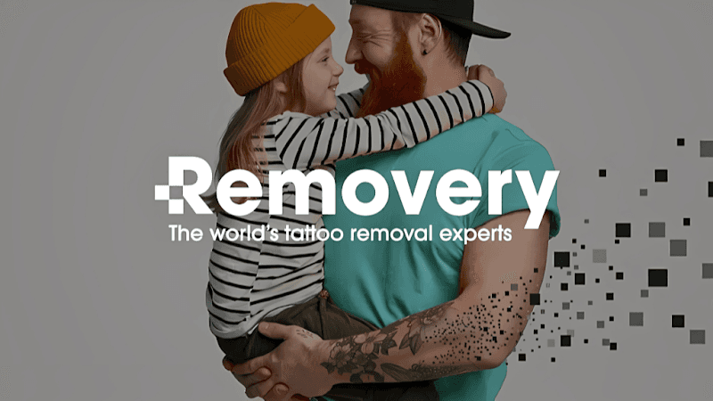 Removery Tattoo Removal & Fading Chesterfield photo
