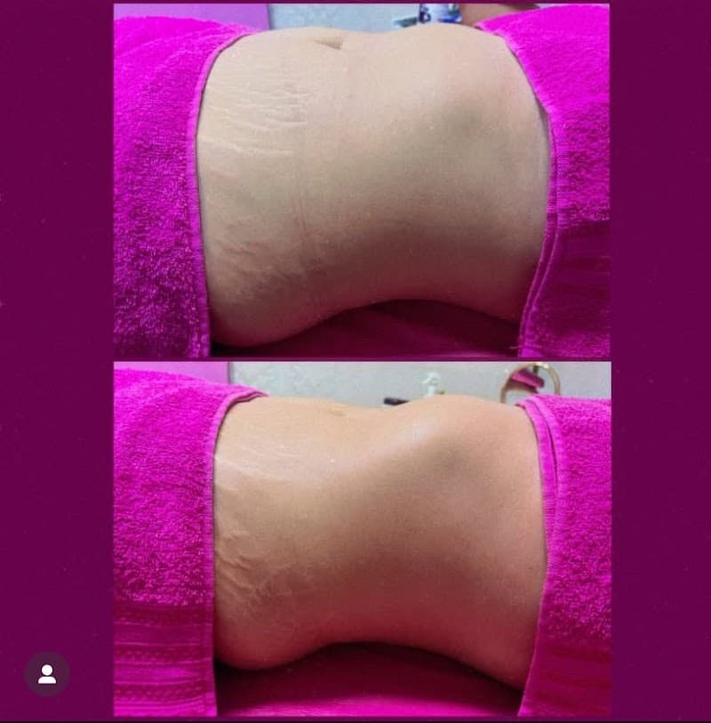 Renovarte Centro Estético Passo Fundo photo