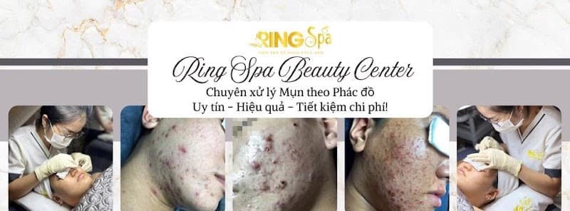 Ring Spa Quận Tân Phú photo