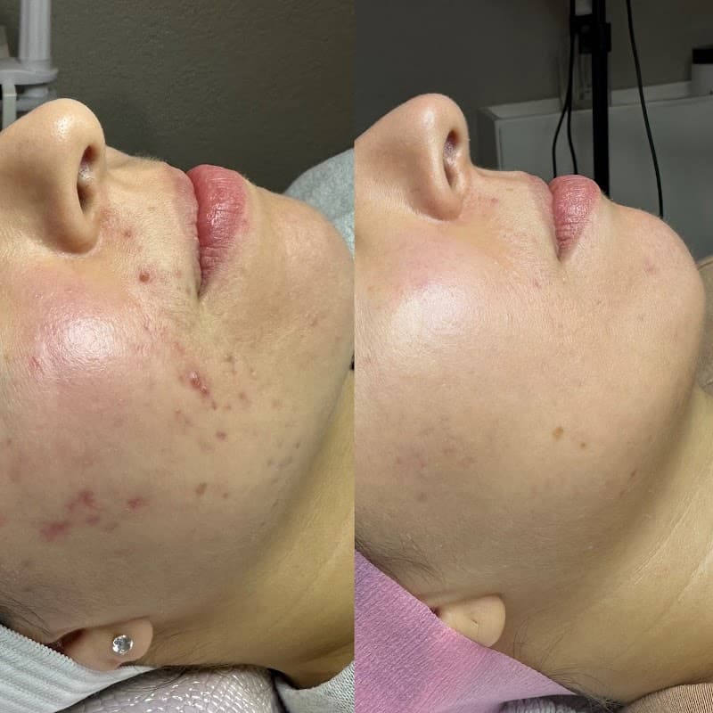 Ritual Esthetics North Richland Hills photo