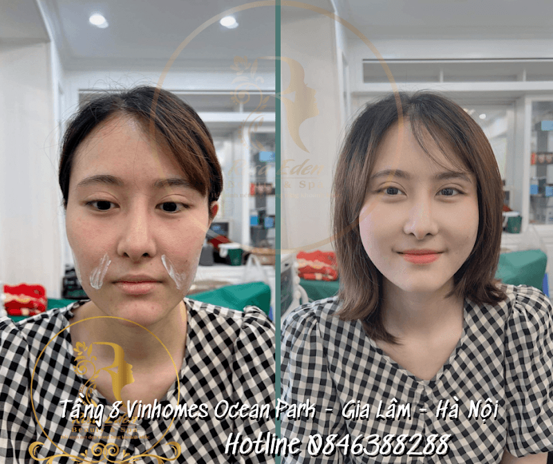 Rosa Eden Spa Huyện Gia Lâm photo