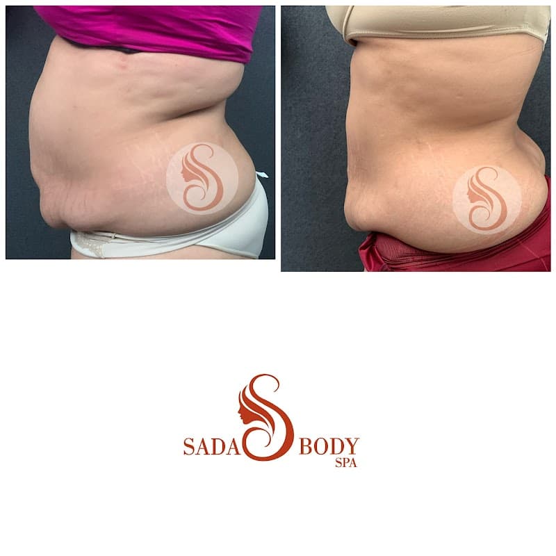 Sada Body Spa León photo