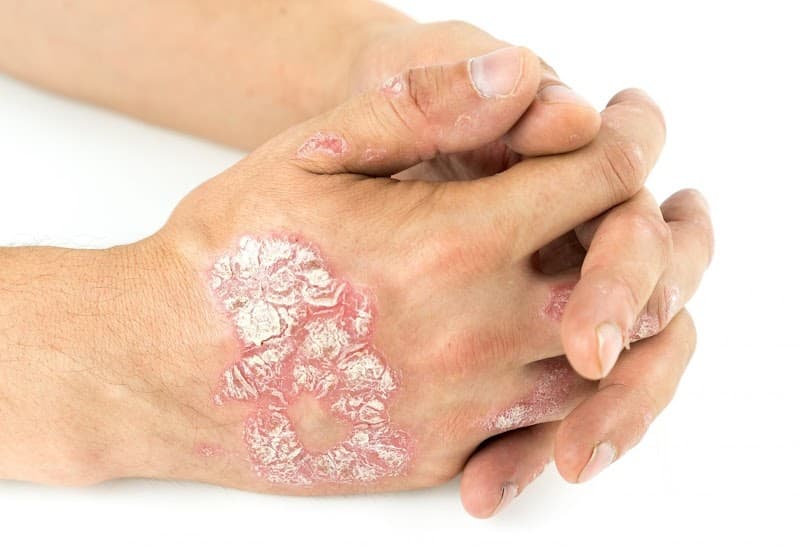 Safe Dermatology & Med Spa of Lansing photo