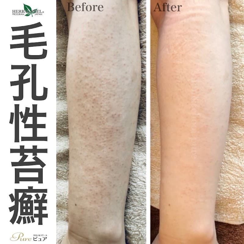 Salon and School Pure Tennoji Ward, Osaka photo