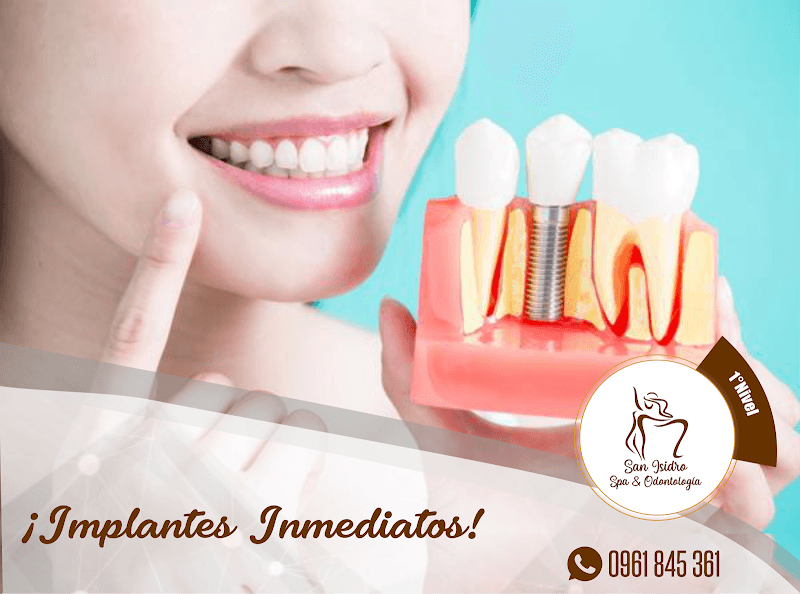 San Isidro SPA San Lorenzo photo