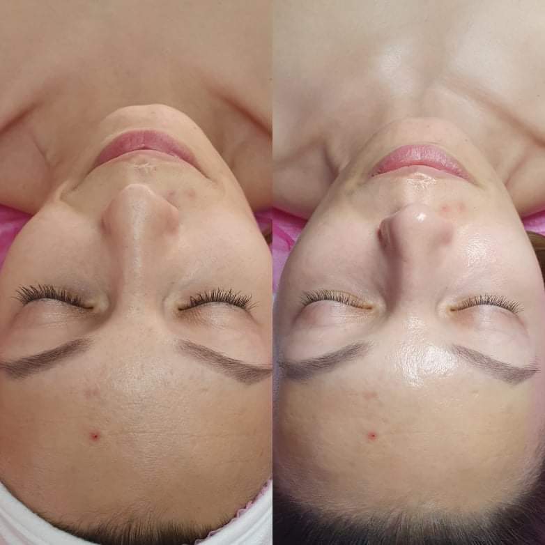 Sandra Estetik Kozmetické Štúdio Poprad photo