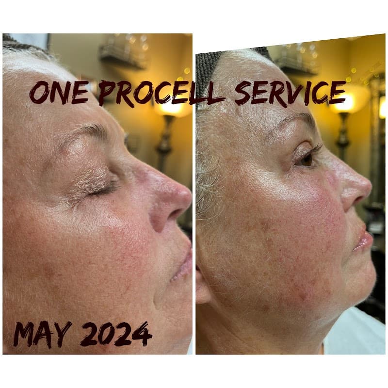 SavantSkin Aesthetics East Longmeadow photo