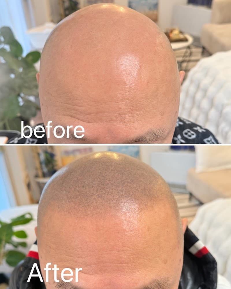 Scalp Hair Quality Improvement Hair Esthe Aires Sapporo Maruyama Store Sapporo Chuo Ward photo