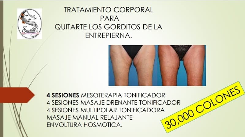 Scarlettaesthetics San José photo