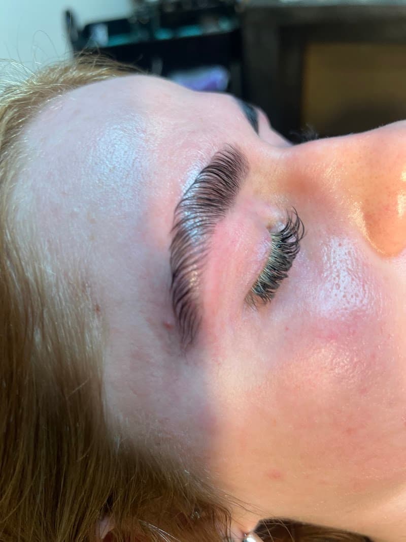 Senaesthetics Andover photo