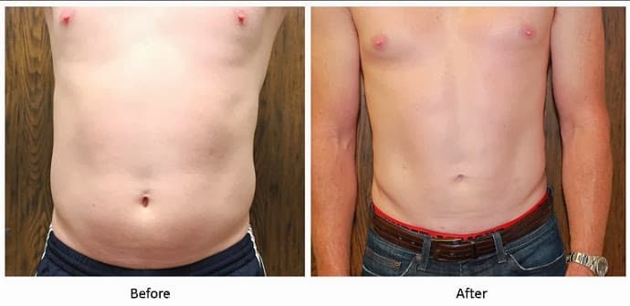 SF Bay Cosmetic Surgery Medical Group Oakland photo