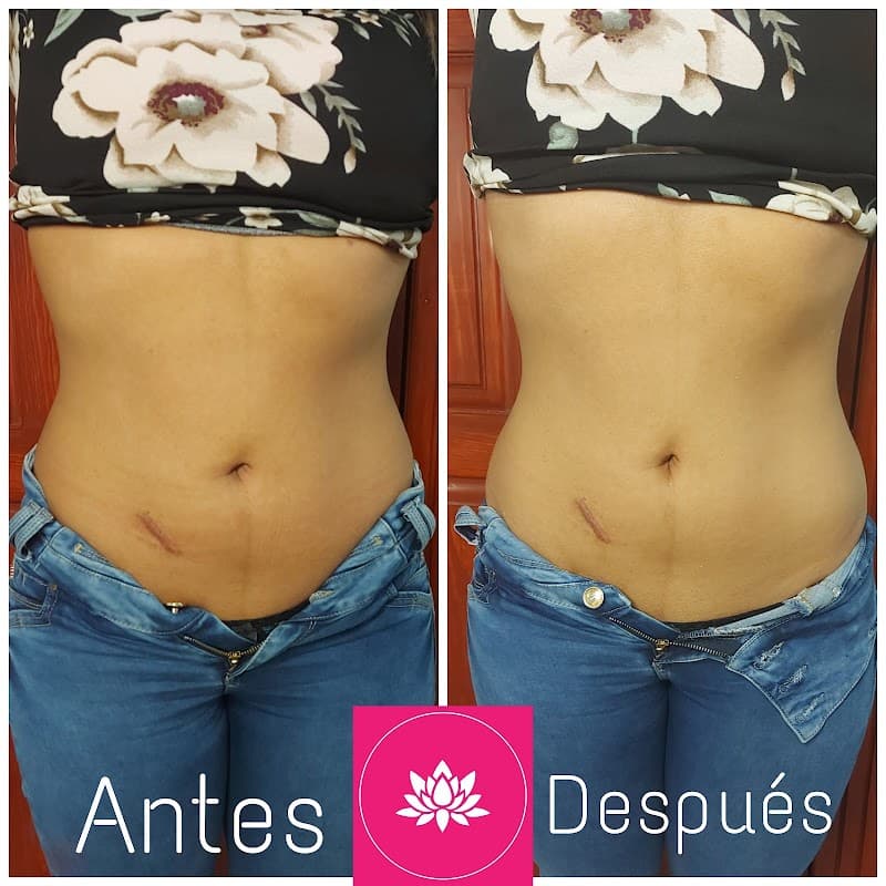 Shalom estetica-spa Cuernavaca photo