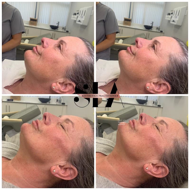 Shelly Elizabeth Aesthetics Washington photo