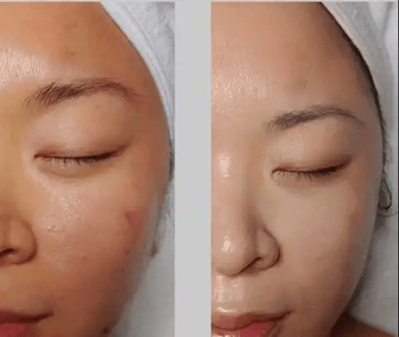 Simply Beautiful Facial Spa Rockville photo