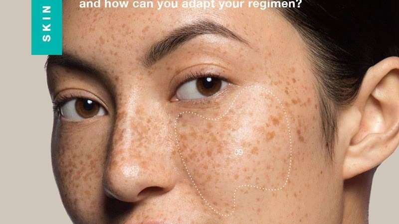 Simply Skin London photo