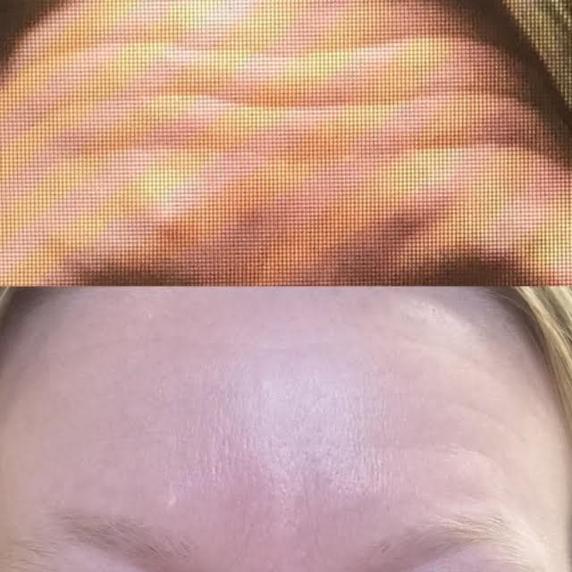 Skin Deep Injectables, LLC Garland photo