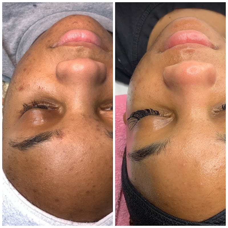 Skin Escape Frisco photo