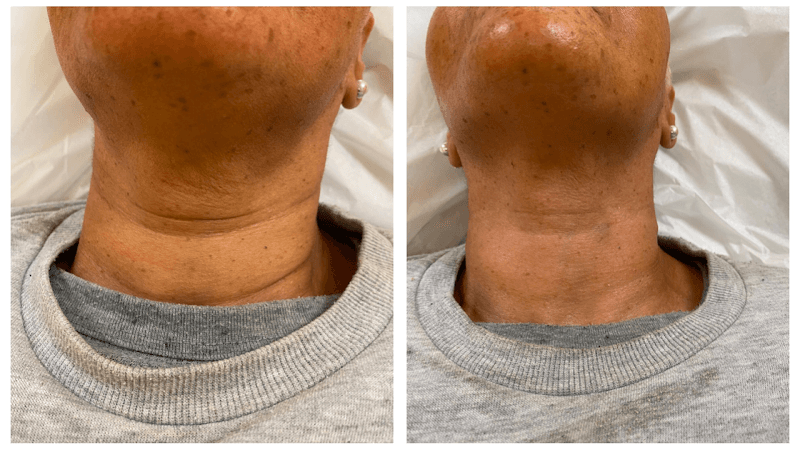 Skin Esteem Medical, Aesthetics, & IV Infusion Spa, Queens New York Saint Albans photo