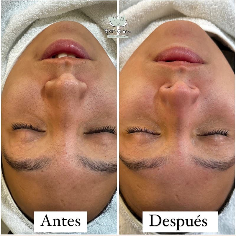 Skin Glow Aguascalientes photo
