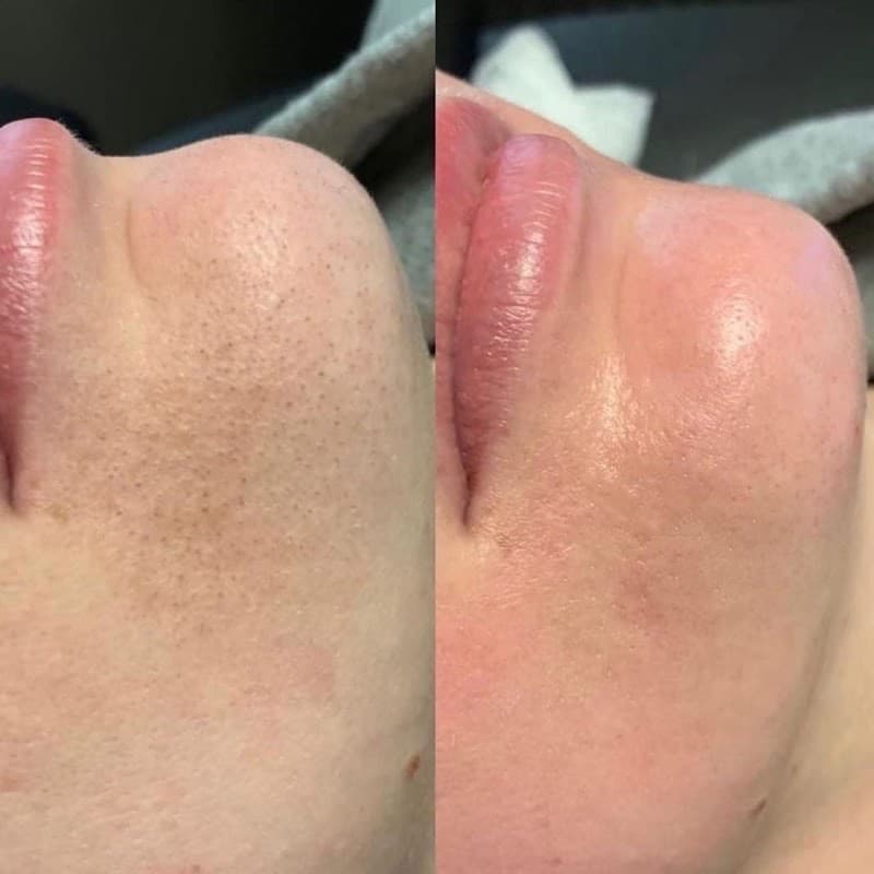 Skin Glow Medspa Fort Worth photo