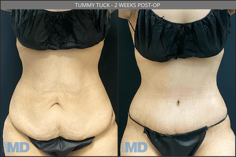 Skin MD - Skin MD Burlington photo