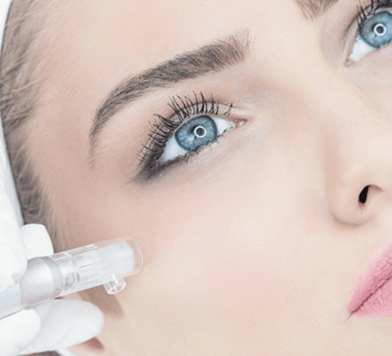 Skin Radiance Medical Spa Dunwoody photo