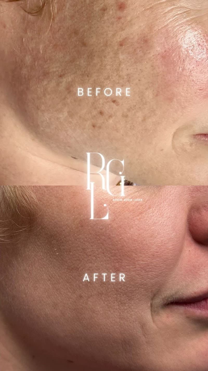 Skin Renewal MedSpa Calgary photo