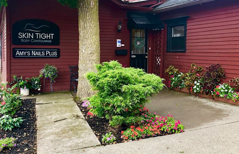 Skin Tight Body Contouring Pittsford photo